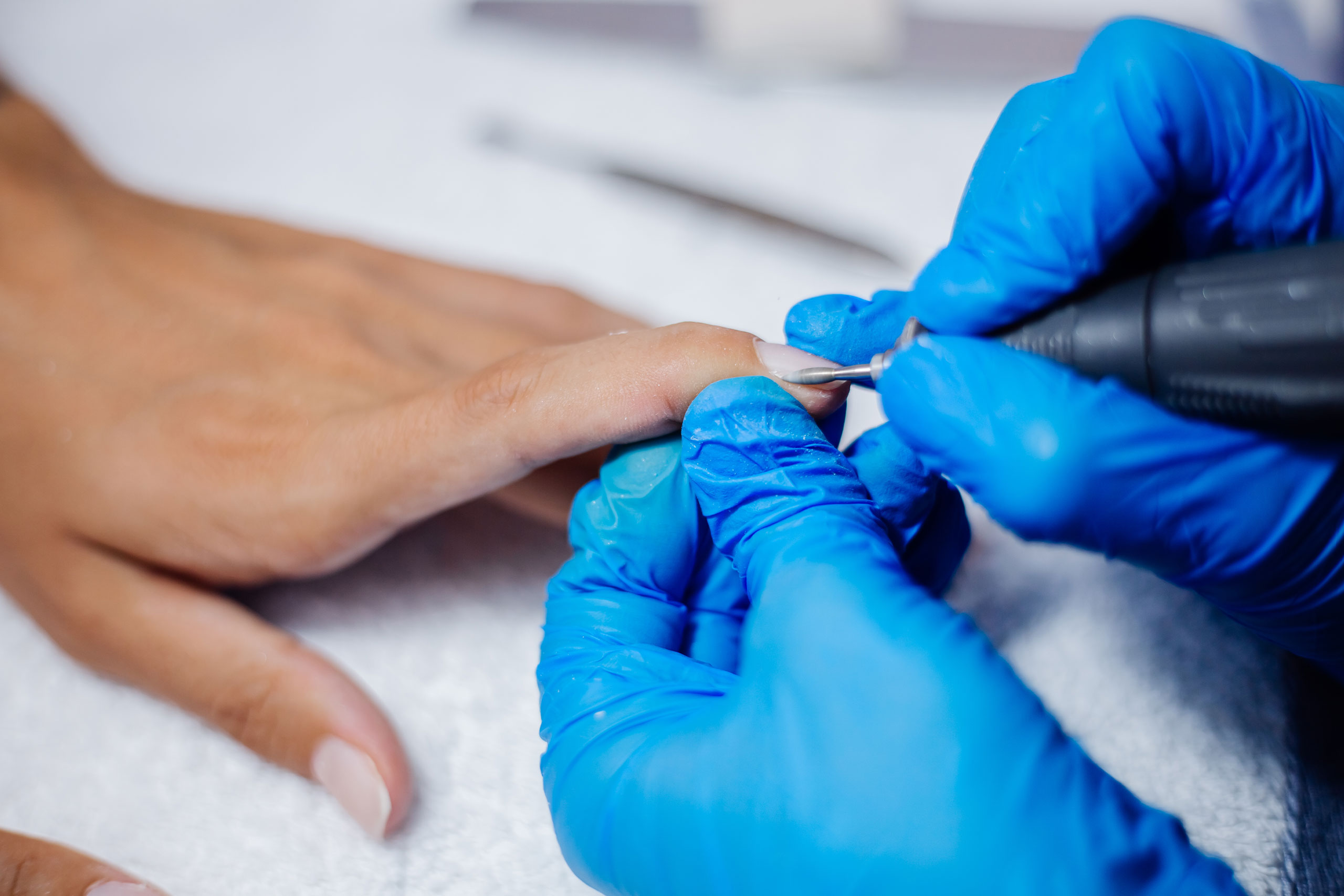 naildisorders