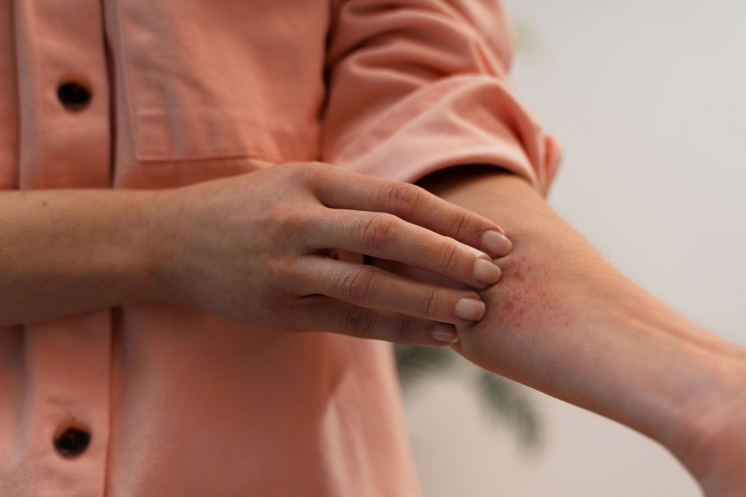 skininfections