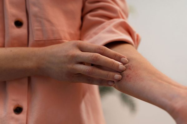 skininfections